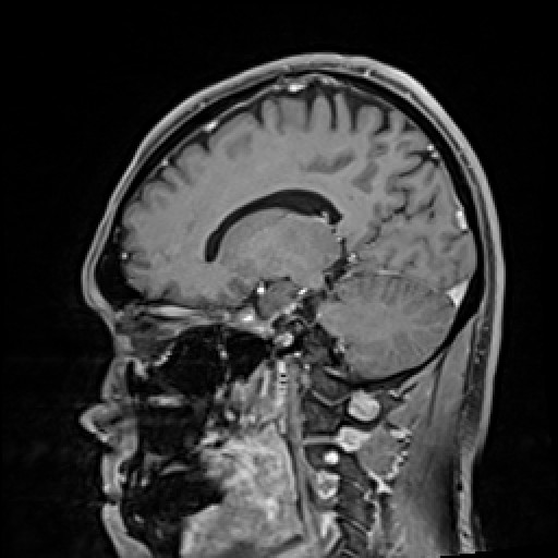 Click on the Serie image to view the images of VILLANUEVA, WILLIAM A.